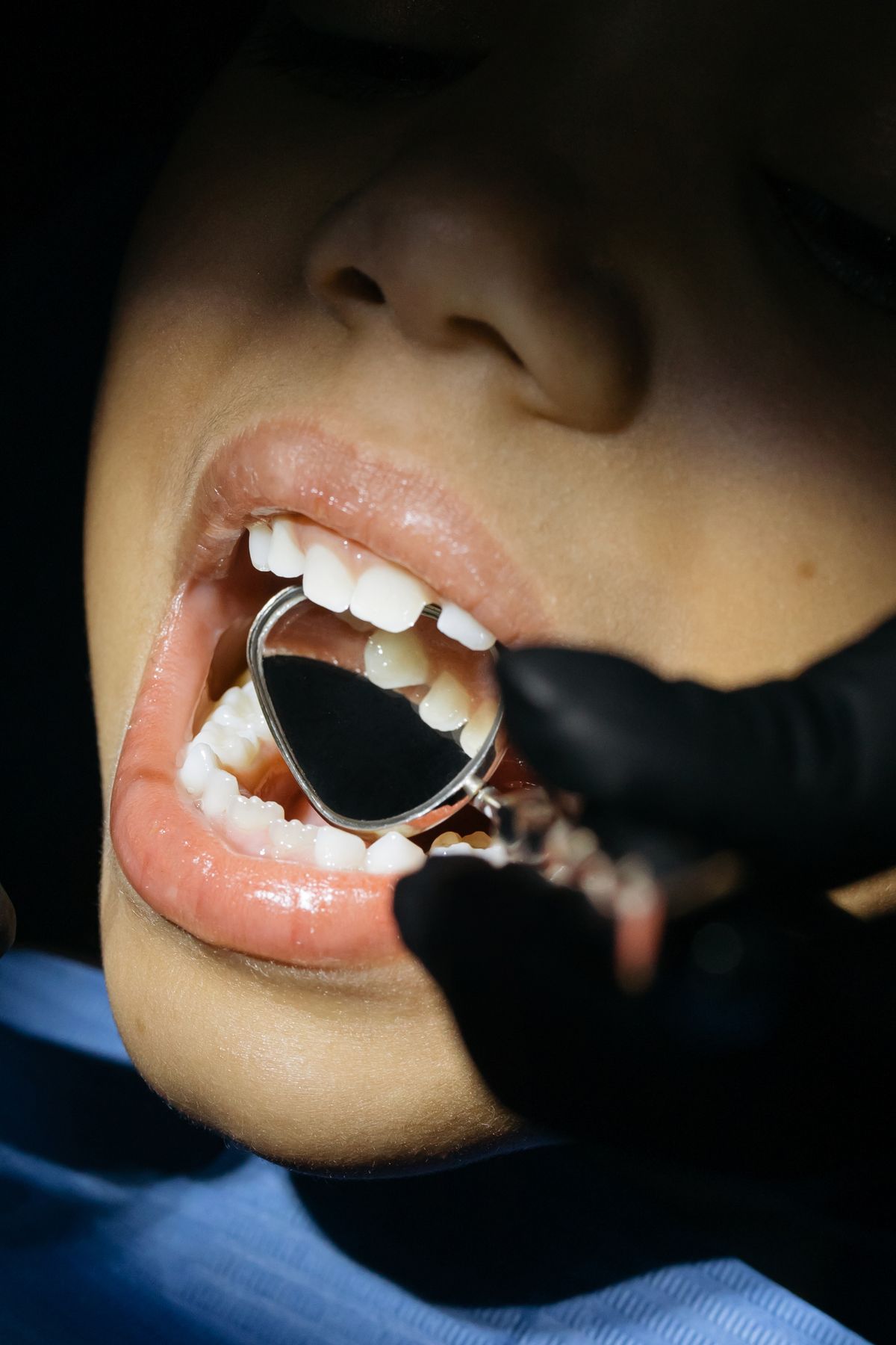 Pediatric Dentistry